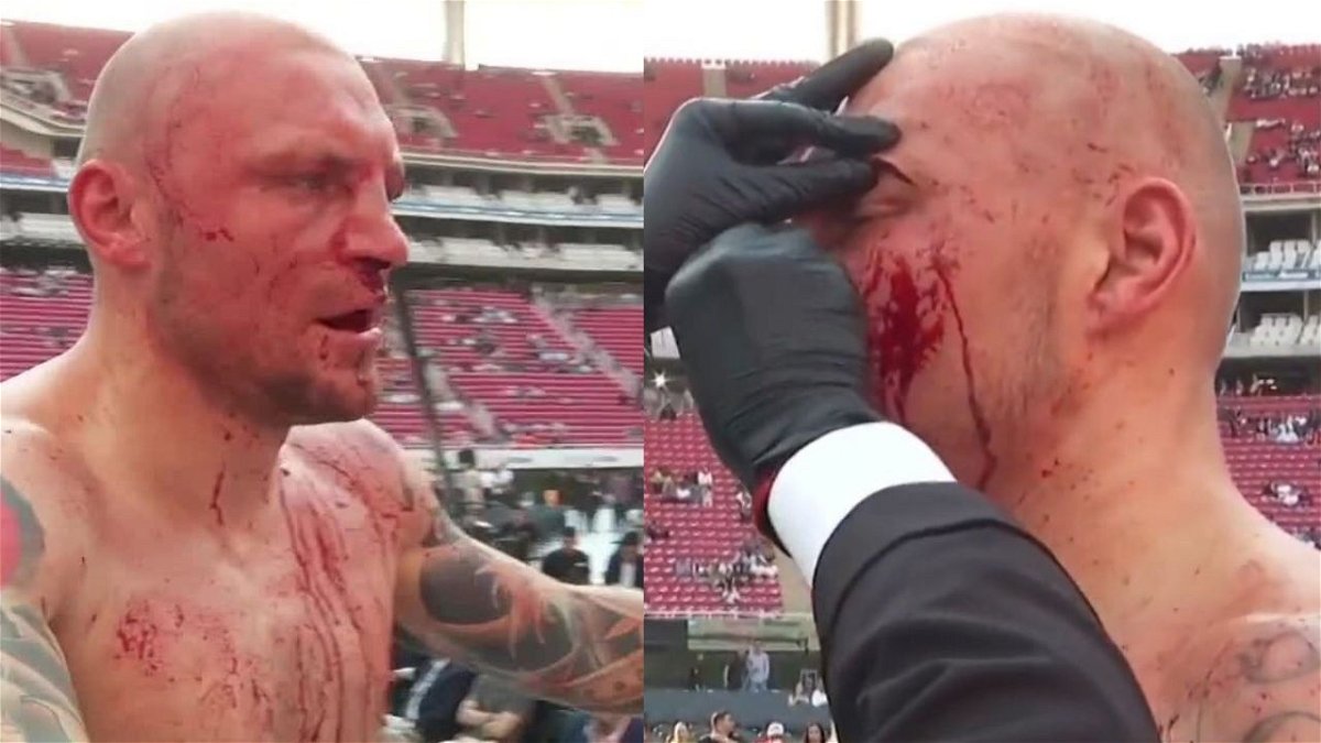 “Blood on the Camera, Damn”: Boxer Suffering Nasty Cut on Canelo vs. Ryder Undercard Sends Fans in Frenzy